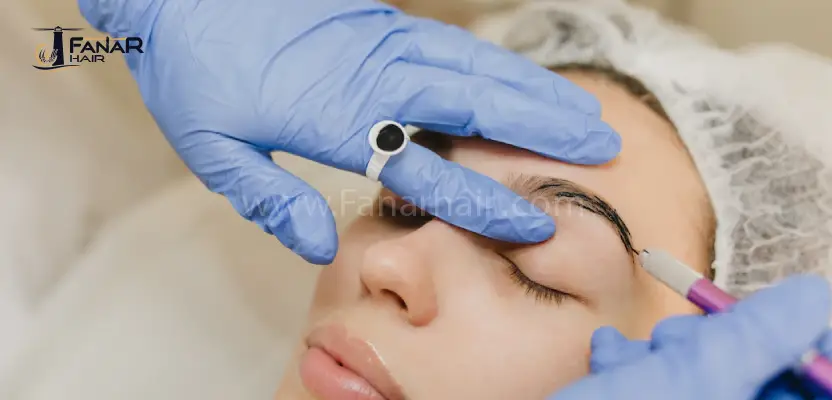 Eyebrow transplantation in Turkey